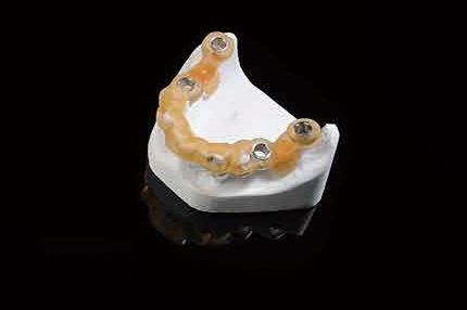 3Dプリンター rapidshape / 総合歯科材料商社 株式会社モモセ歯科商会